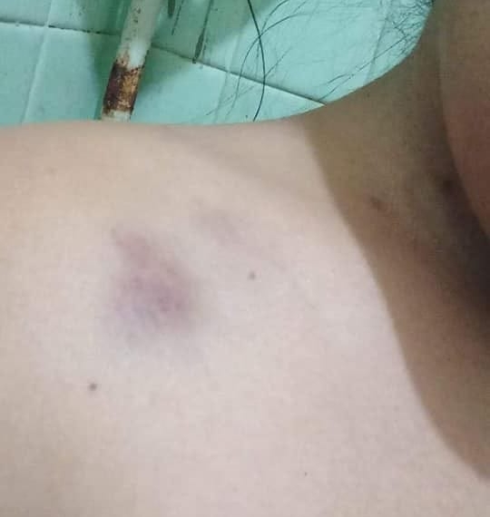 Golpean a una mujer en silla de ruedas acompañada de su perrito