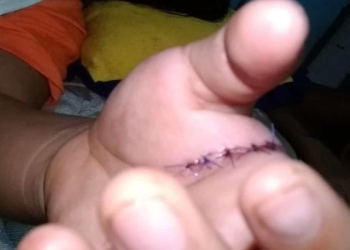 Hombre ataca a una mujer en Motul; el agresor lesionó a la víctima con un arma blanca